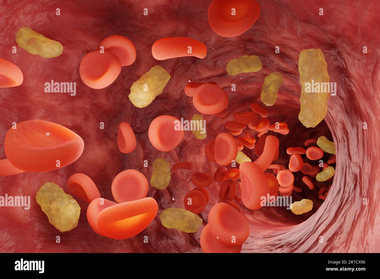 Red blood cells and yellow bacteria flowing in blood vessel. Concept of a severe medical condition sepsis in which bacteria enter the blood Stock Photo