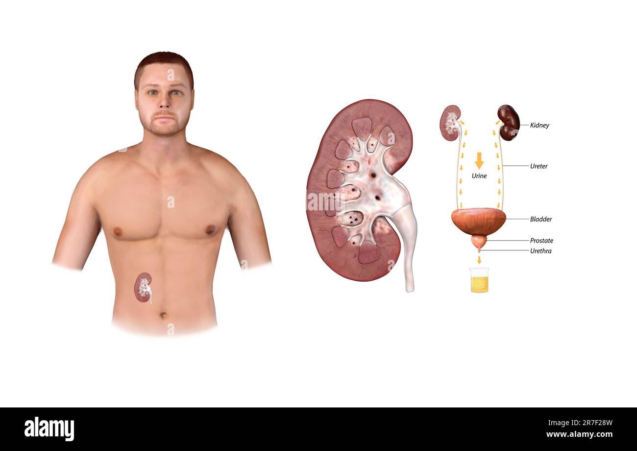 Collection of urine from the bladder, urine draining from the kidneys