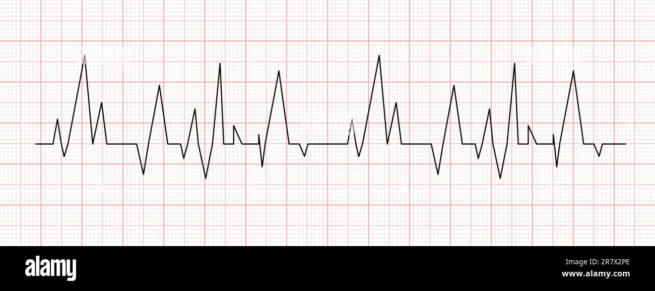 Black Heartbeat Chart On Red Graph Paper. Electrocardiogram Line 