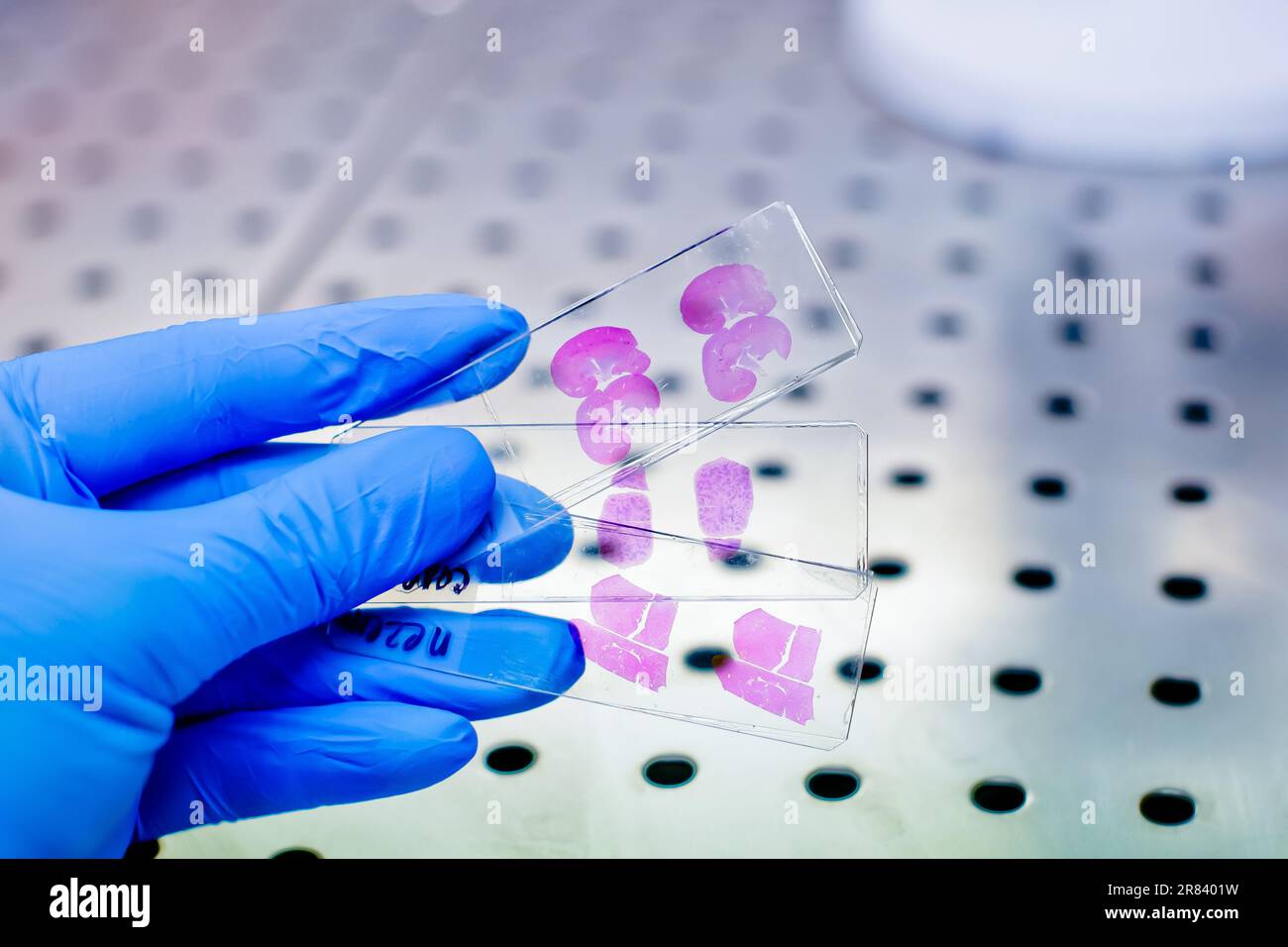 Close up photo of hand in blue glove handing histological liver tissue