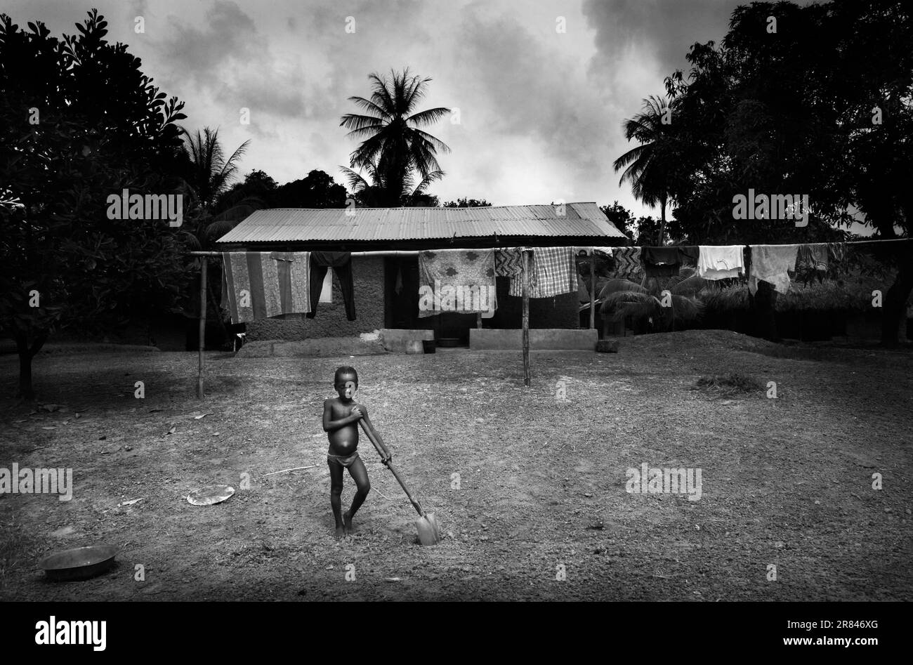 Malaria in Sierra Leone. Stock Photo