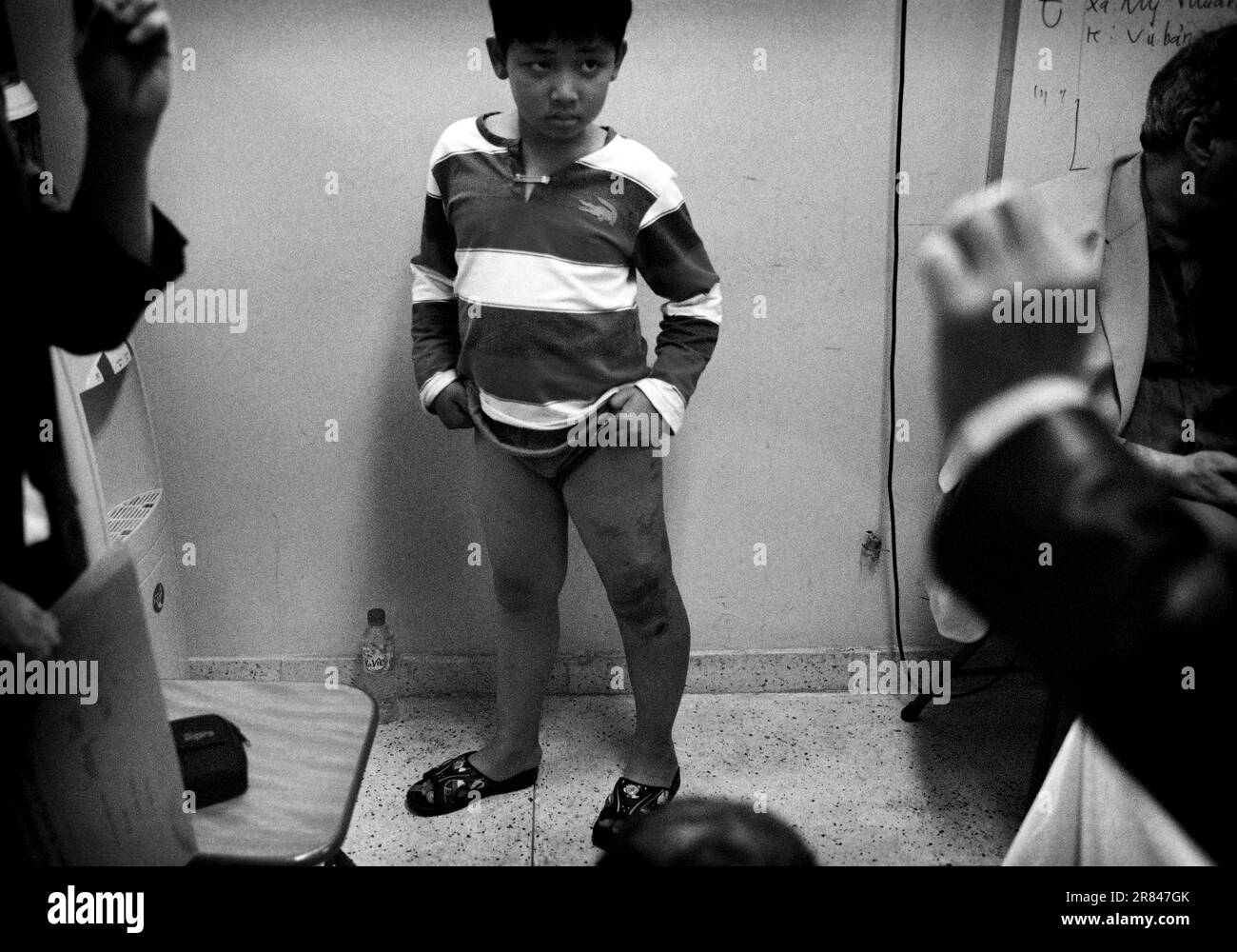 Boy being examined by surgeons at Hanoi Pediatrics Hospital, Han Stock Photo