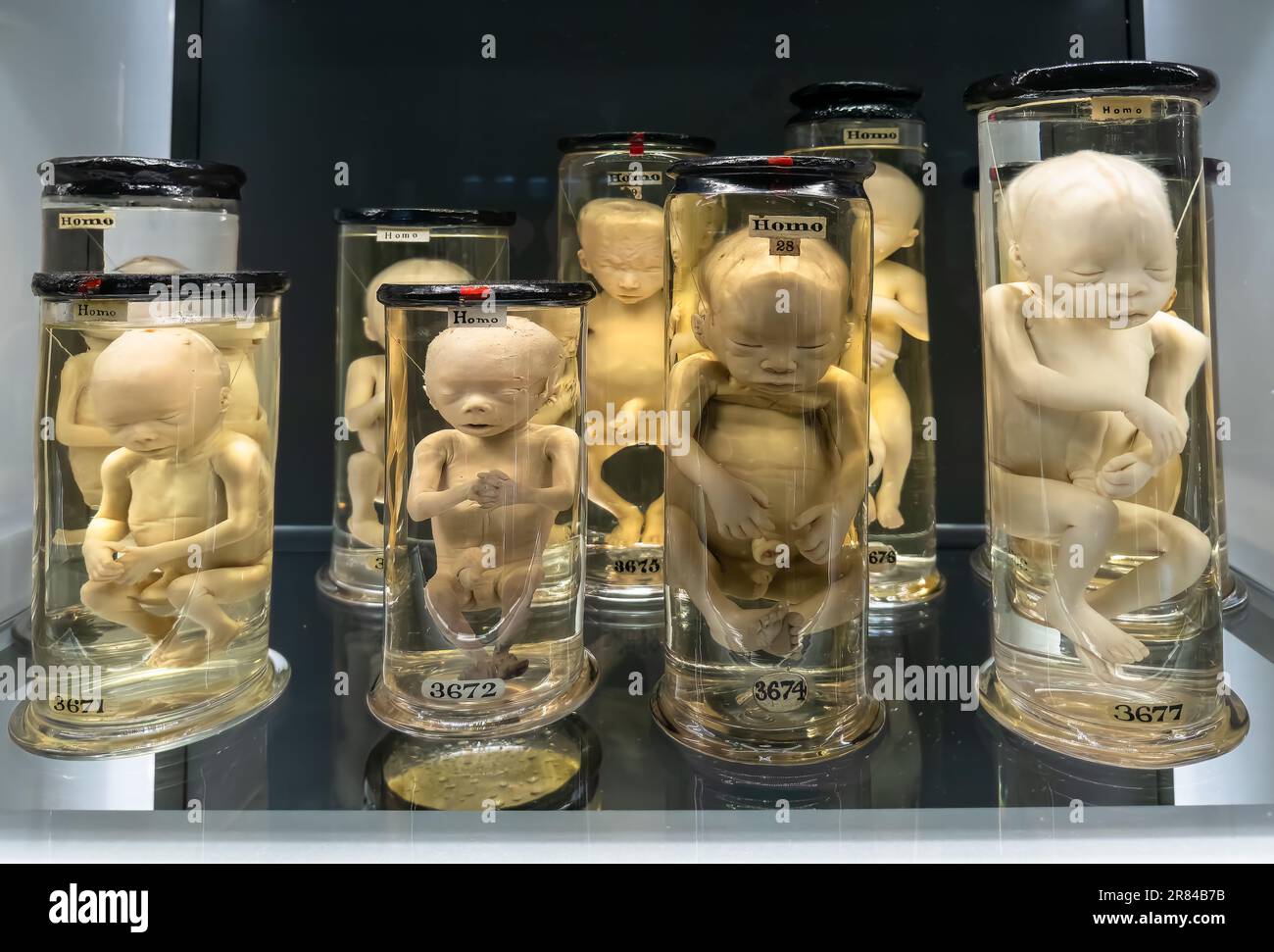 Human fetuses preserved in formaldehyde on display at the Hunterian