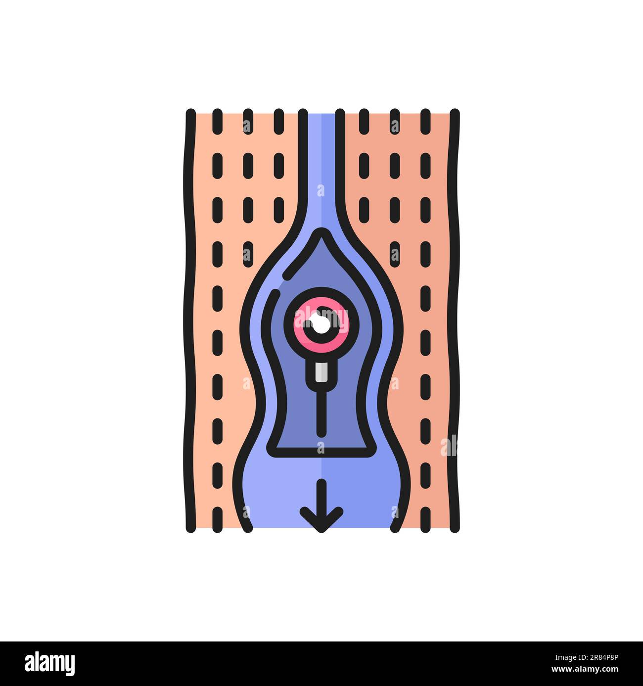 Abnormal blood flow, thrombosis and cardiovascular disease color