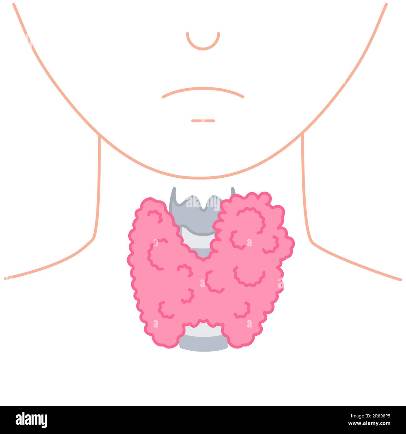 Enlarged thyroid gland on neck silhouette diagram Stock Vector Image