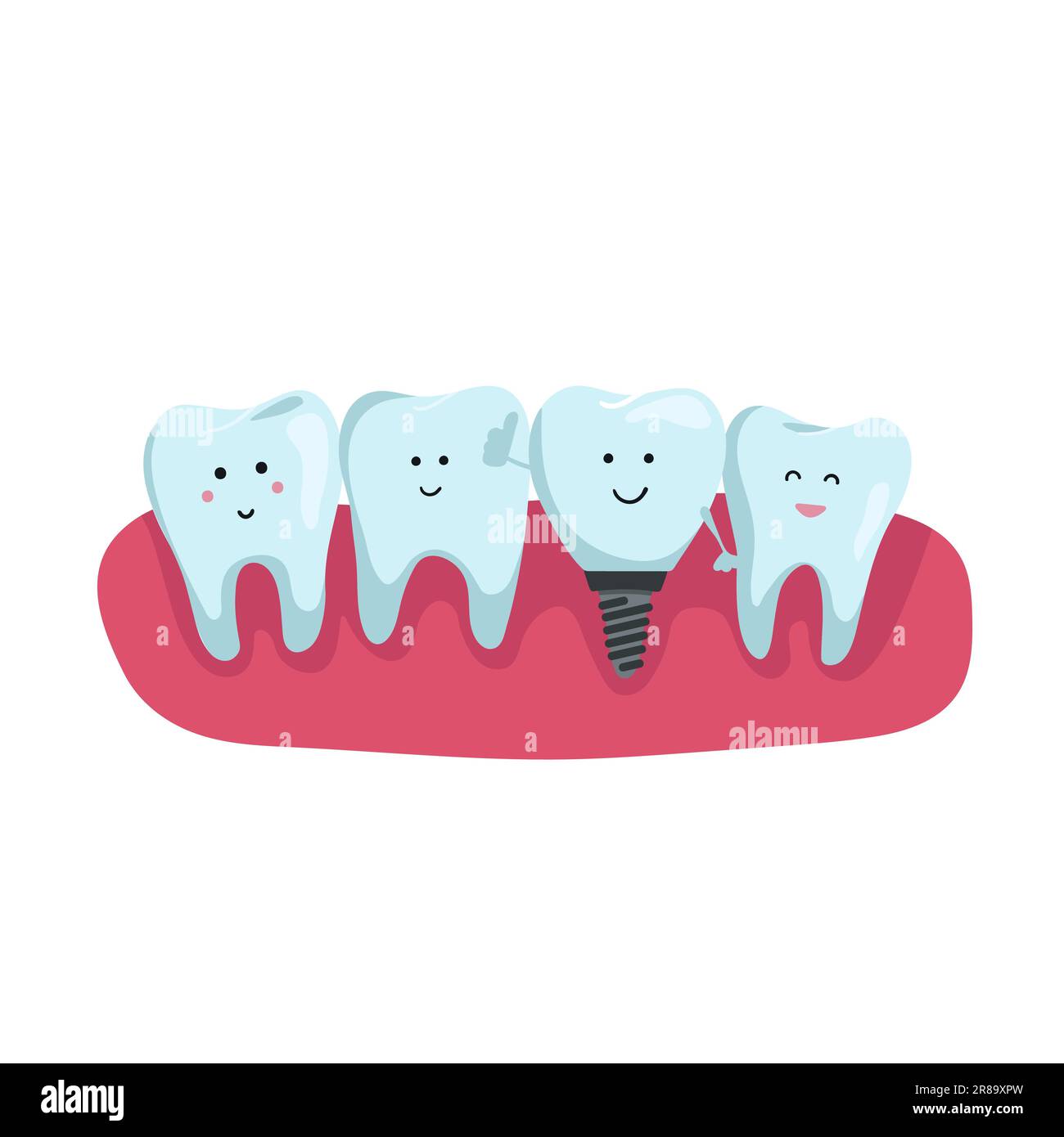 dentition on the gum. Teeth with dental implant cartoon in flat design