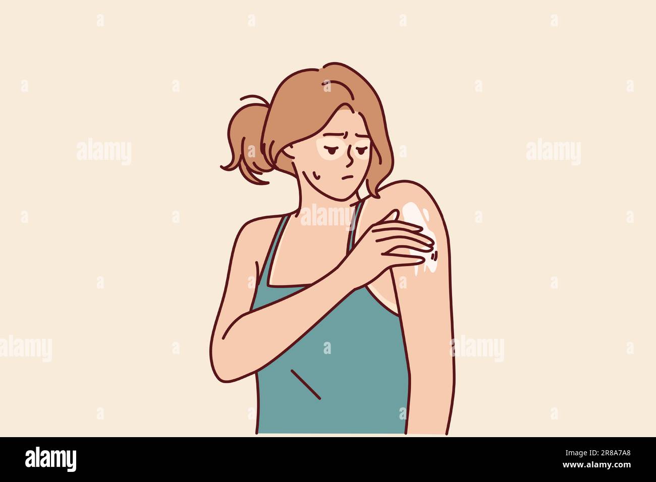 Woman with sunburned applies healing cream on shoulder to repair skin