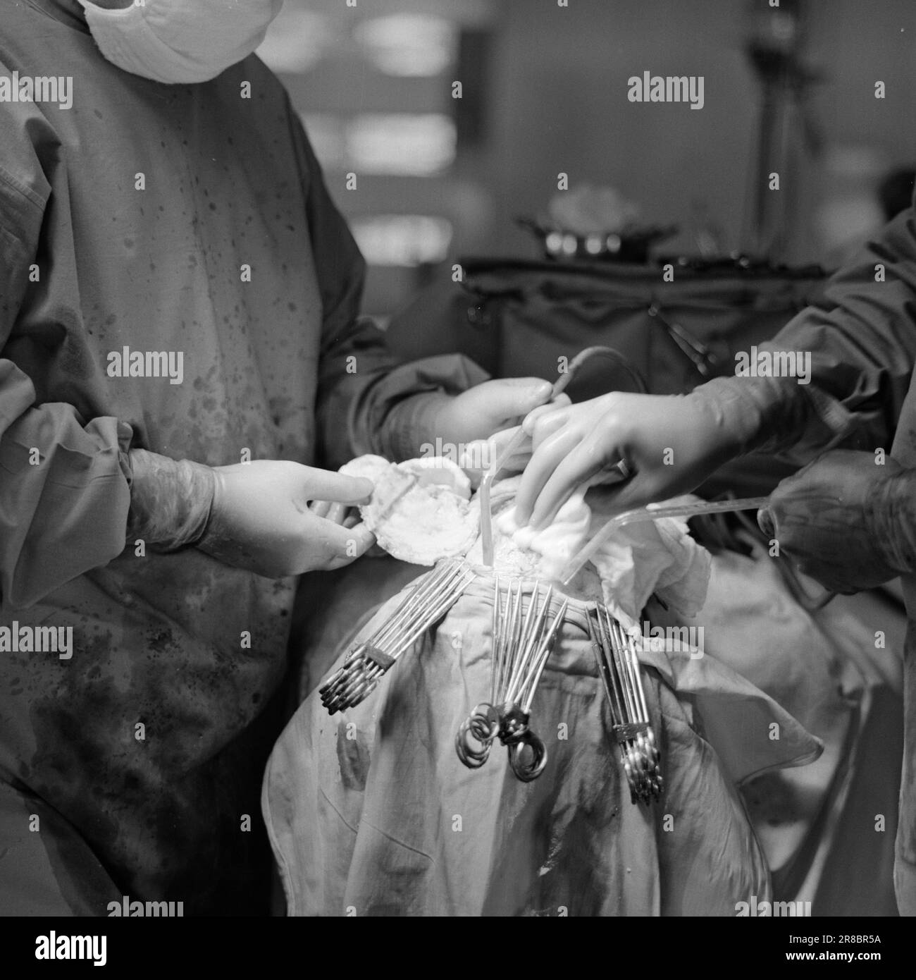 Cut Open Head Surgery