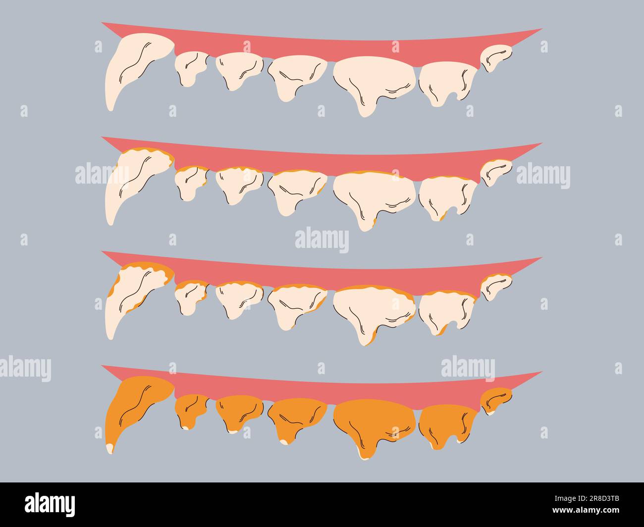 Stages of plaque and tartar formation in dogs. Gum disease prevention