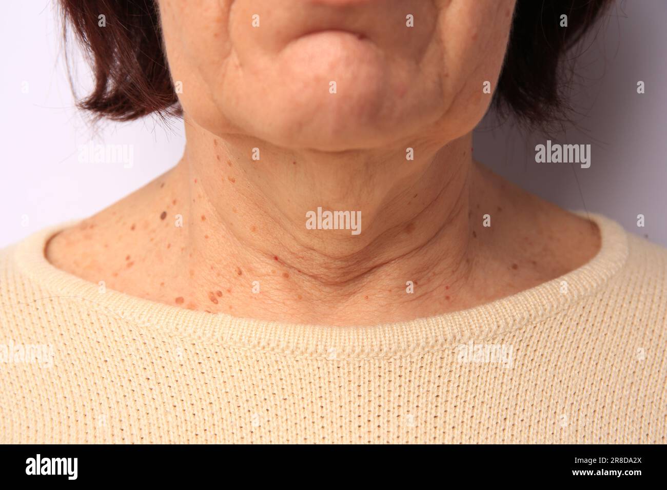 Old woman face antiaging hi-res stock photography and images - Alamy