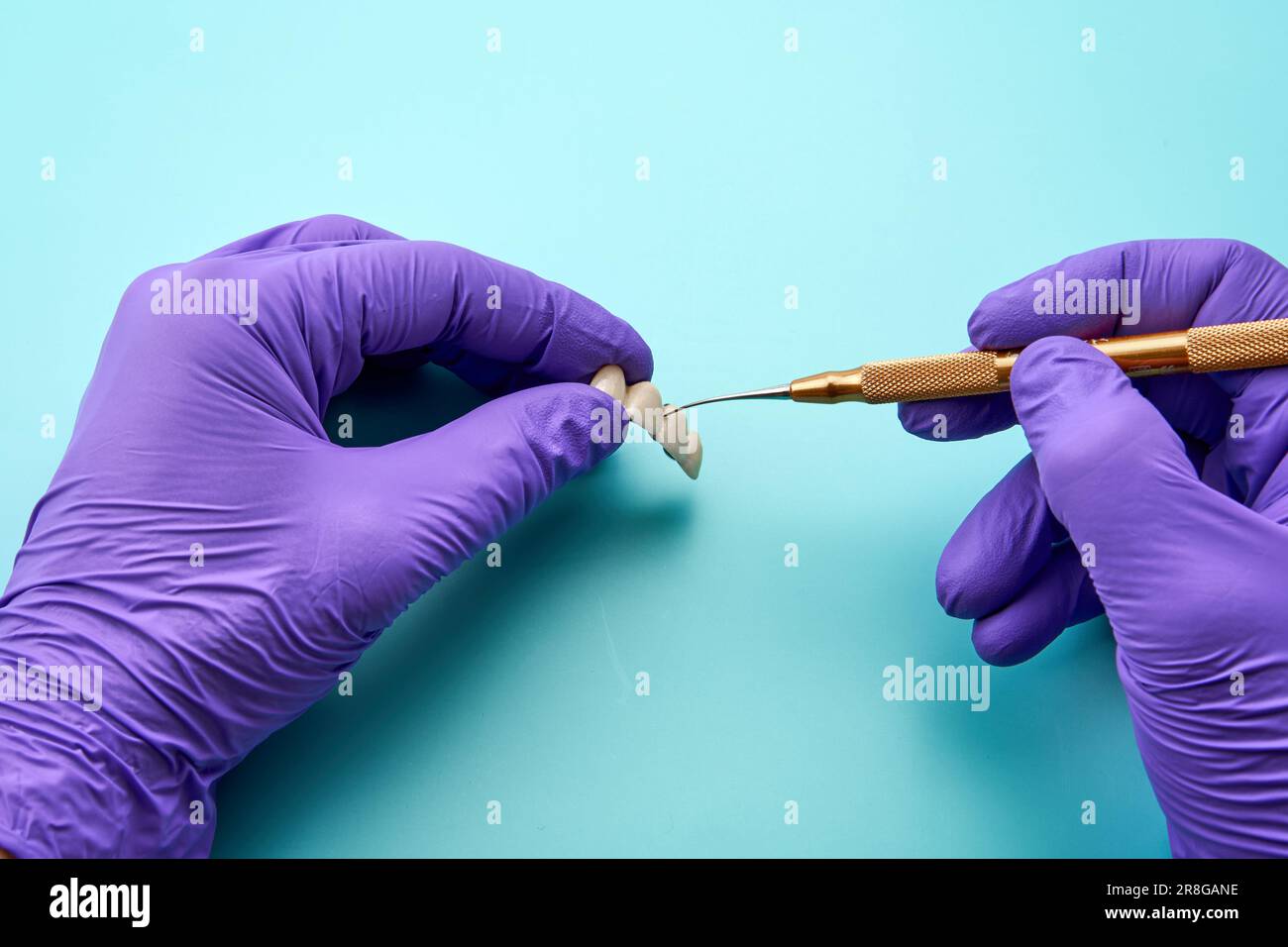 Dental technician working with a dental prosthetic appliance on a green