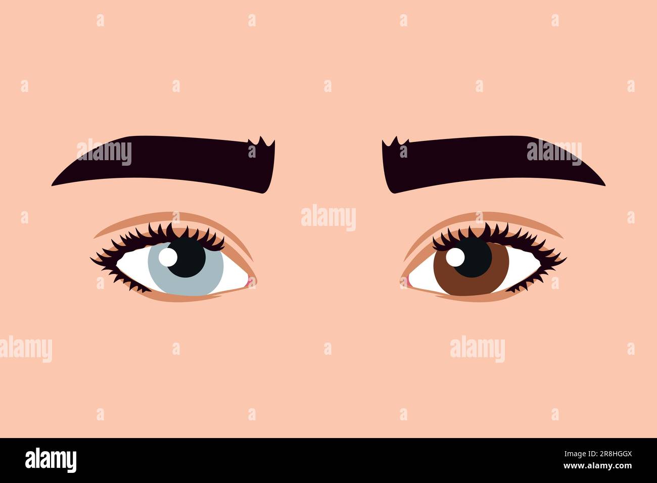 Different colored eyes. Heterochromia. Blue and brown eye colors. Multicolored retina, retina of