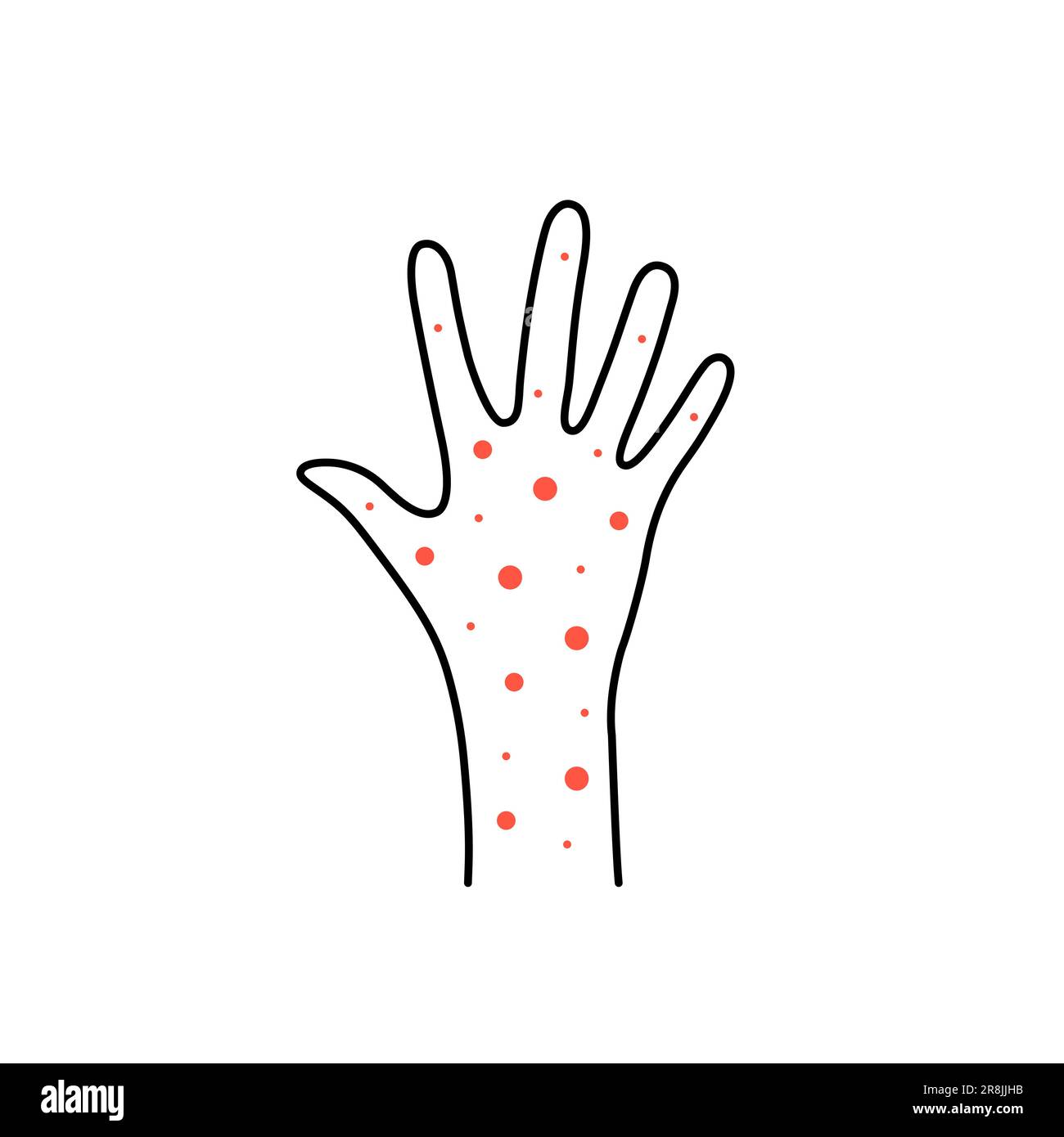 linear hand with rash or psoriasis Stock Vector
