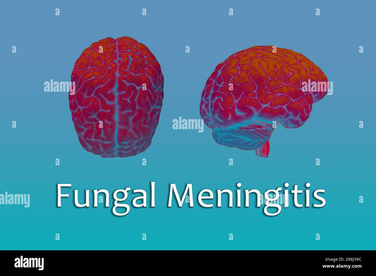 Meningitis symptoms hi-res stock photography and images - Alamy