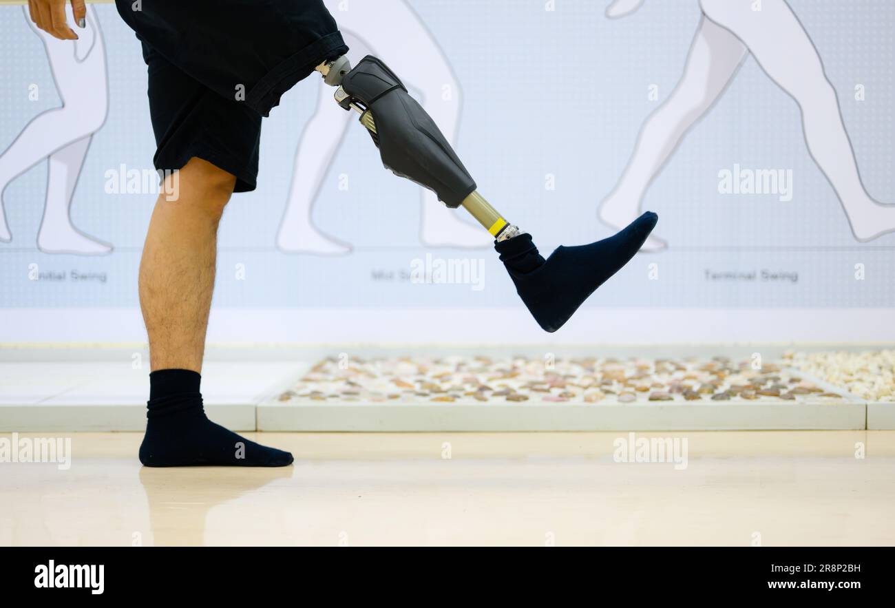 Disabled athlete patient with physical disability doing exercise Stock