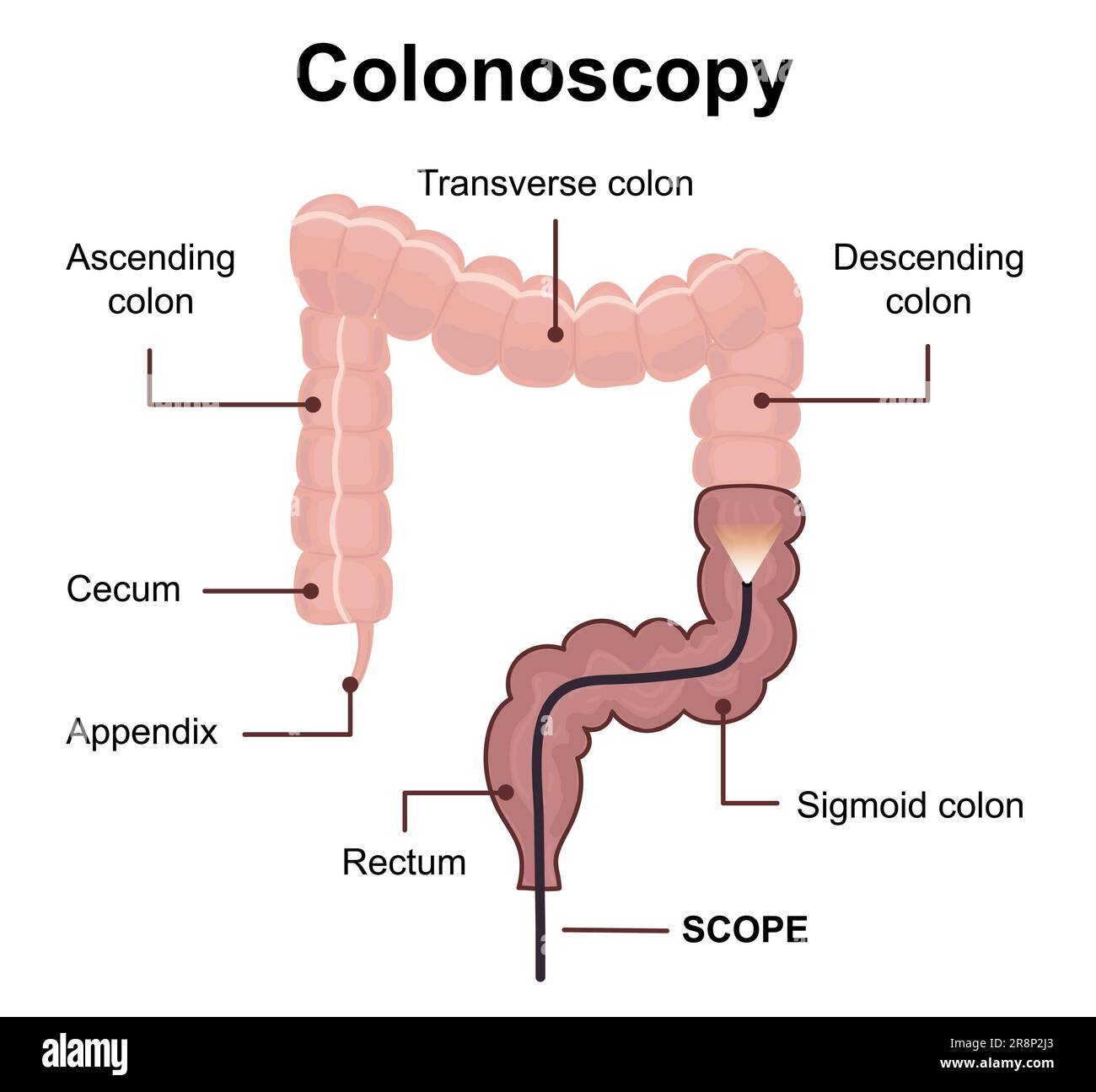 Colonoscopy technology concept with rendering endoscope inside of intestine. Medical diagram of colon with anatomical terms. Vector illustration Stock Vector
