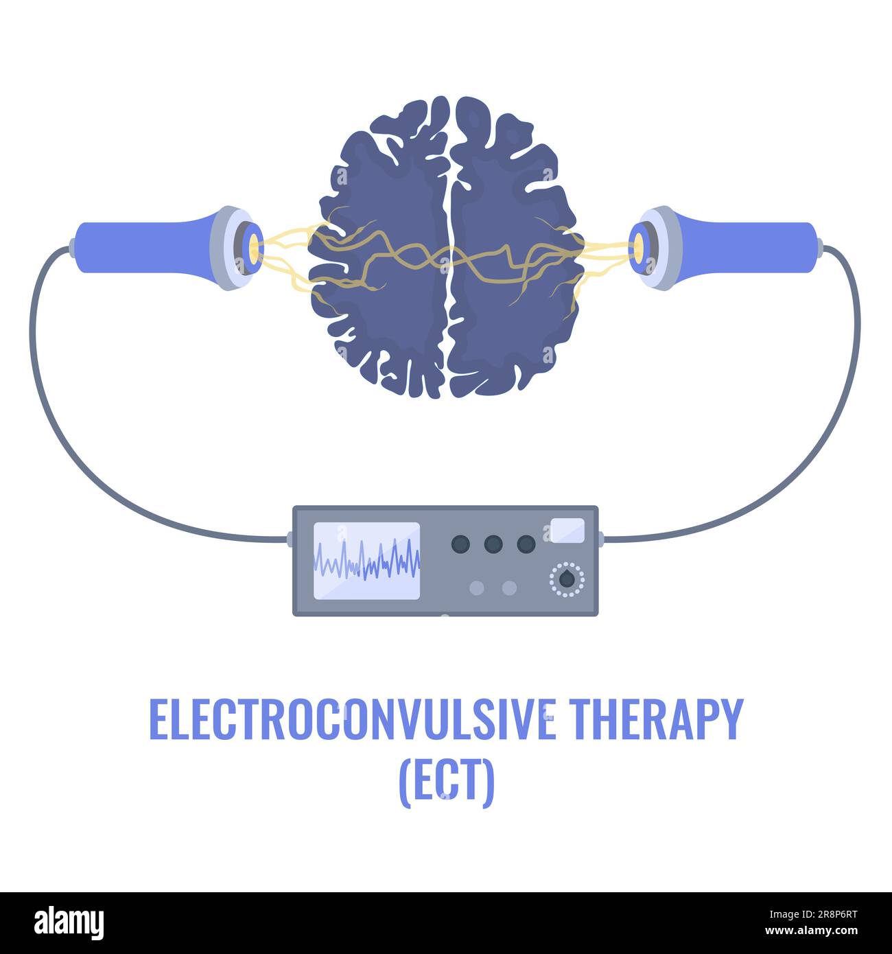 Vintage electroconvulsive therapy / medical electroshock therapy device for  psychiatric treatment Stock Photo - Alamy