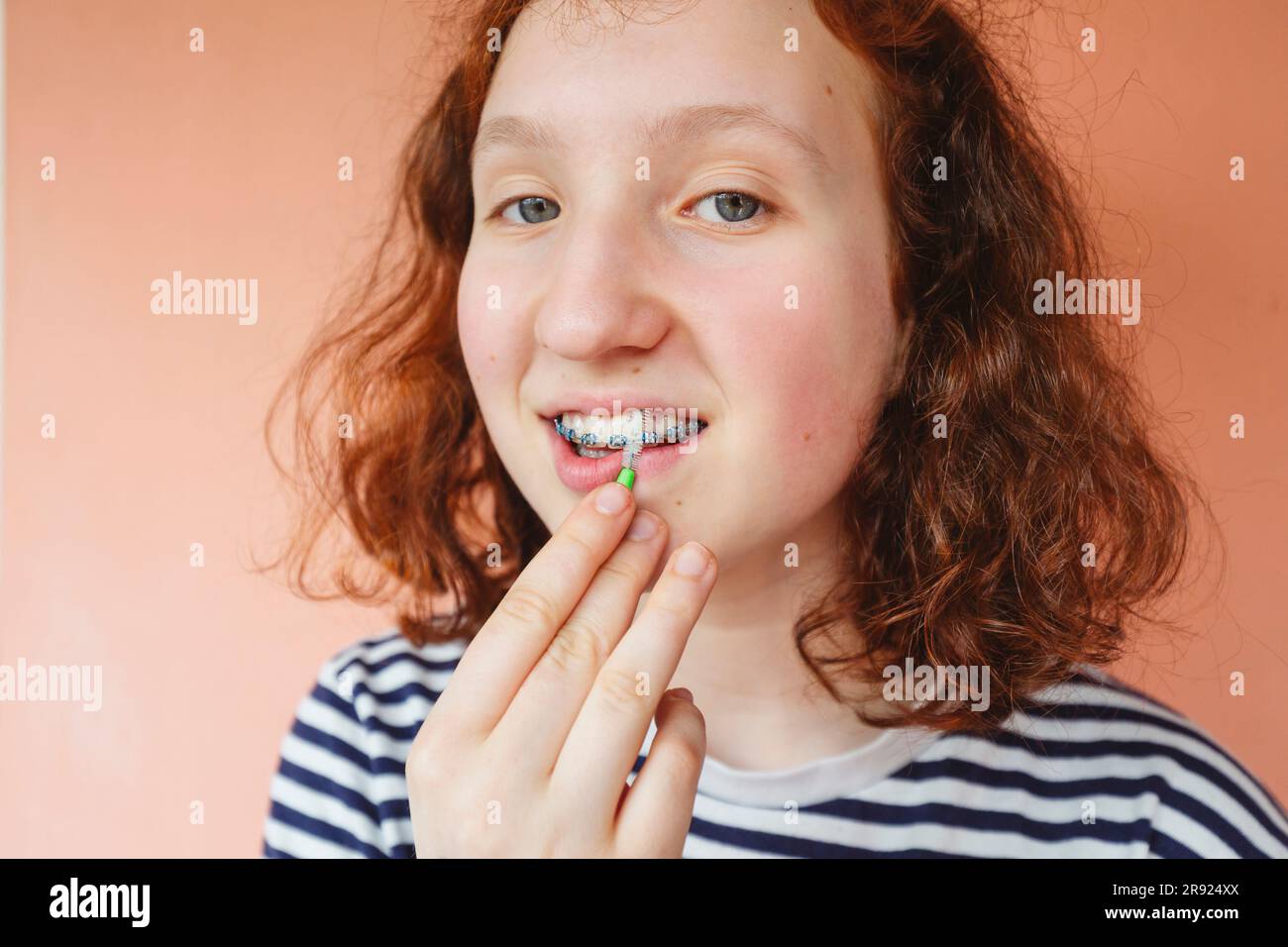 Girl cleaning dental braces with interdental brush Stock Photo Alamy