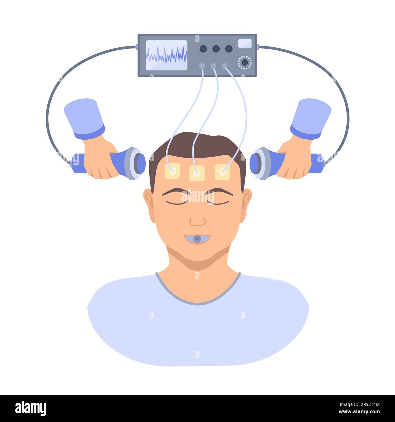 Electroconvulsive therapy, illustration Stock Photo Alamy