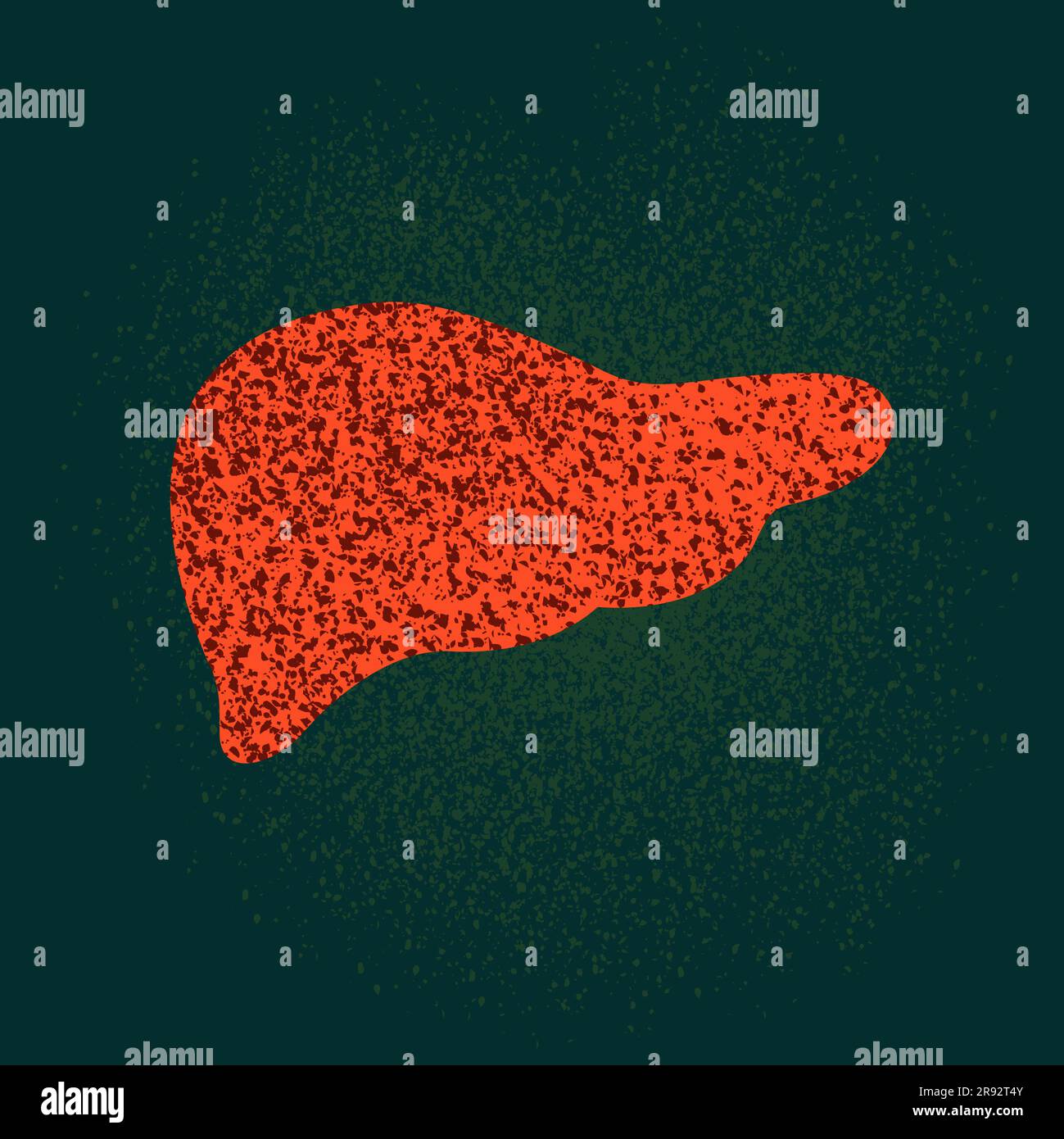 Liver disease, conceptual illustration Stock Photo Alamy
