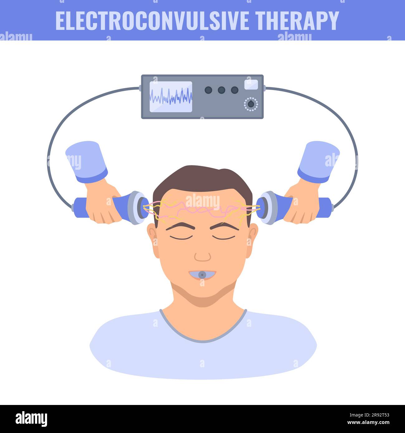 Electroconvulsive therapy (ECT), illustration Stock Photo Alamy
