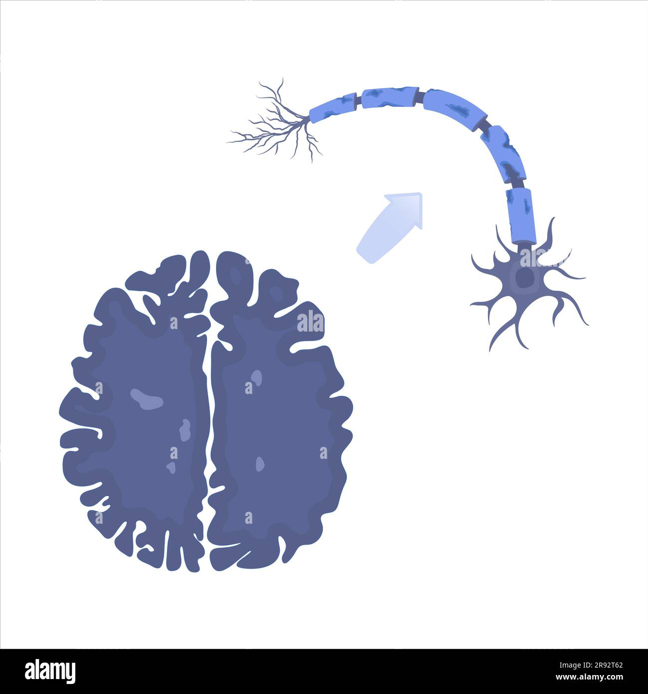 Multiple sclerosis, conceptual illustration Stock Photo Alamy