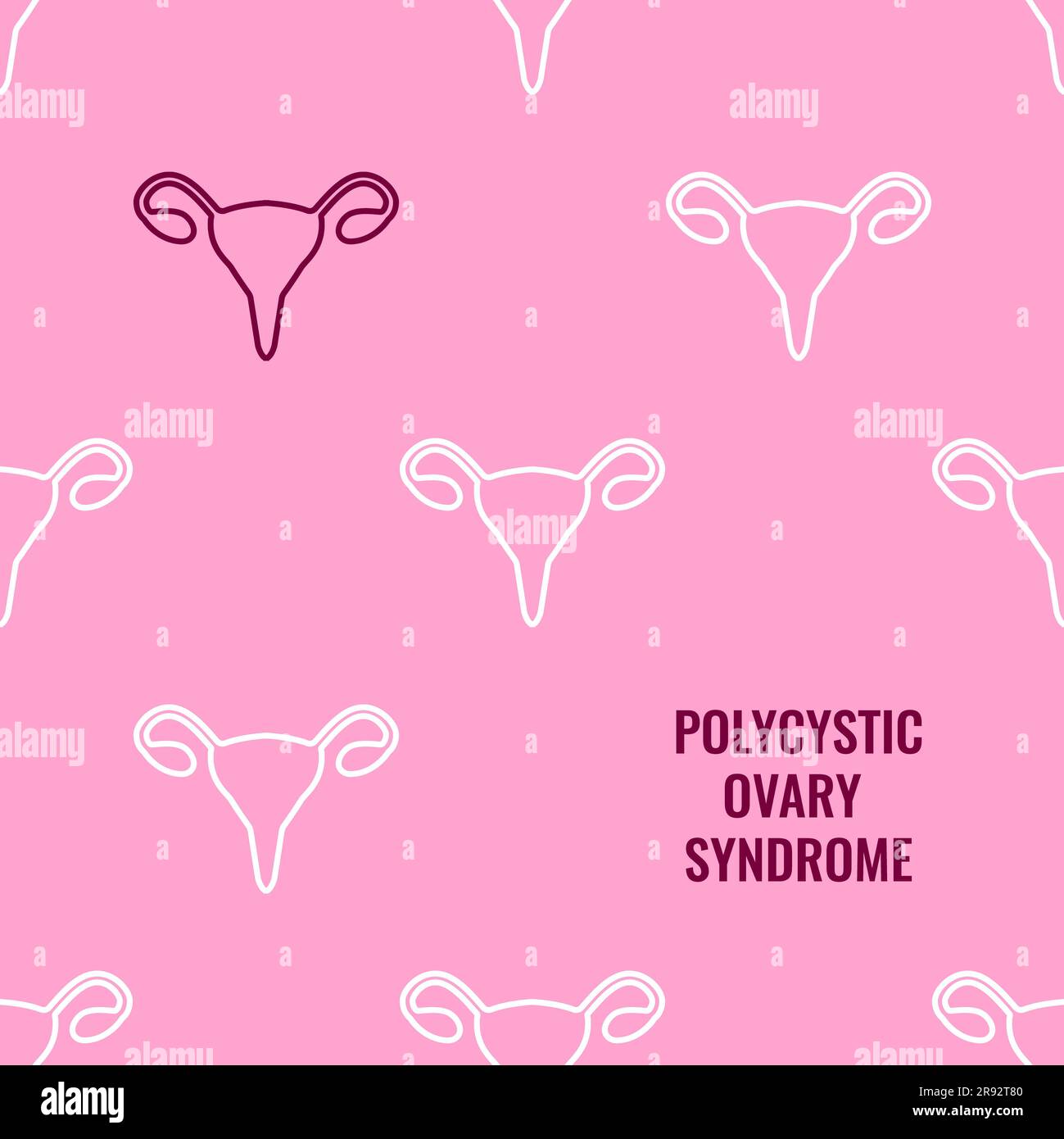 Polycystic ovary syndrome awareness, conceptual illustration Stock ...