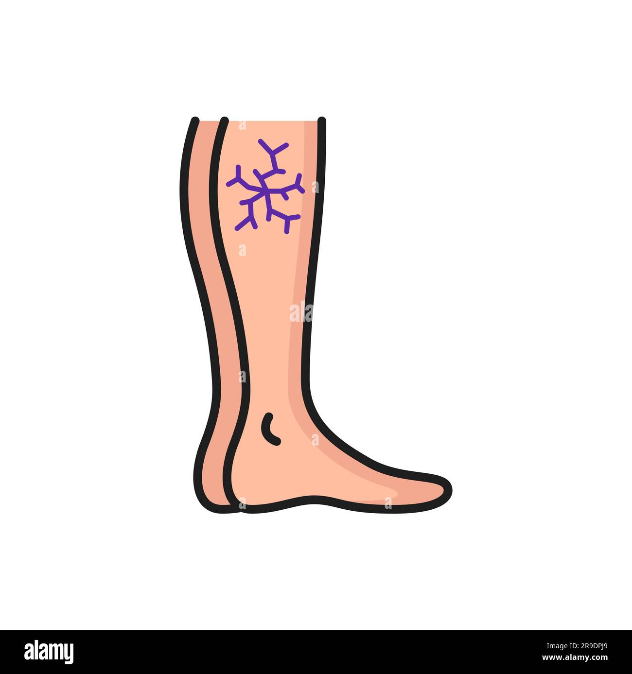 Varicose veins, leg with vascular net outline icon. Vector swelling