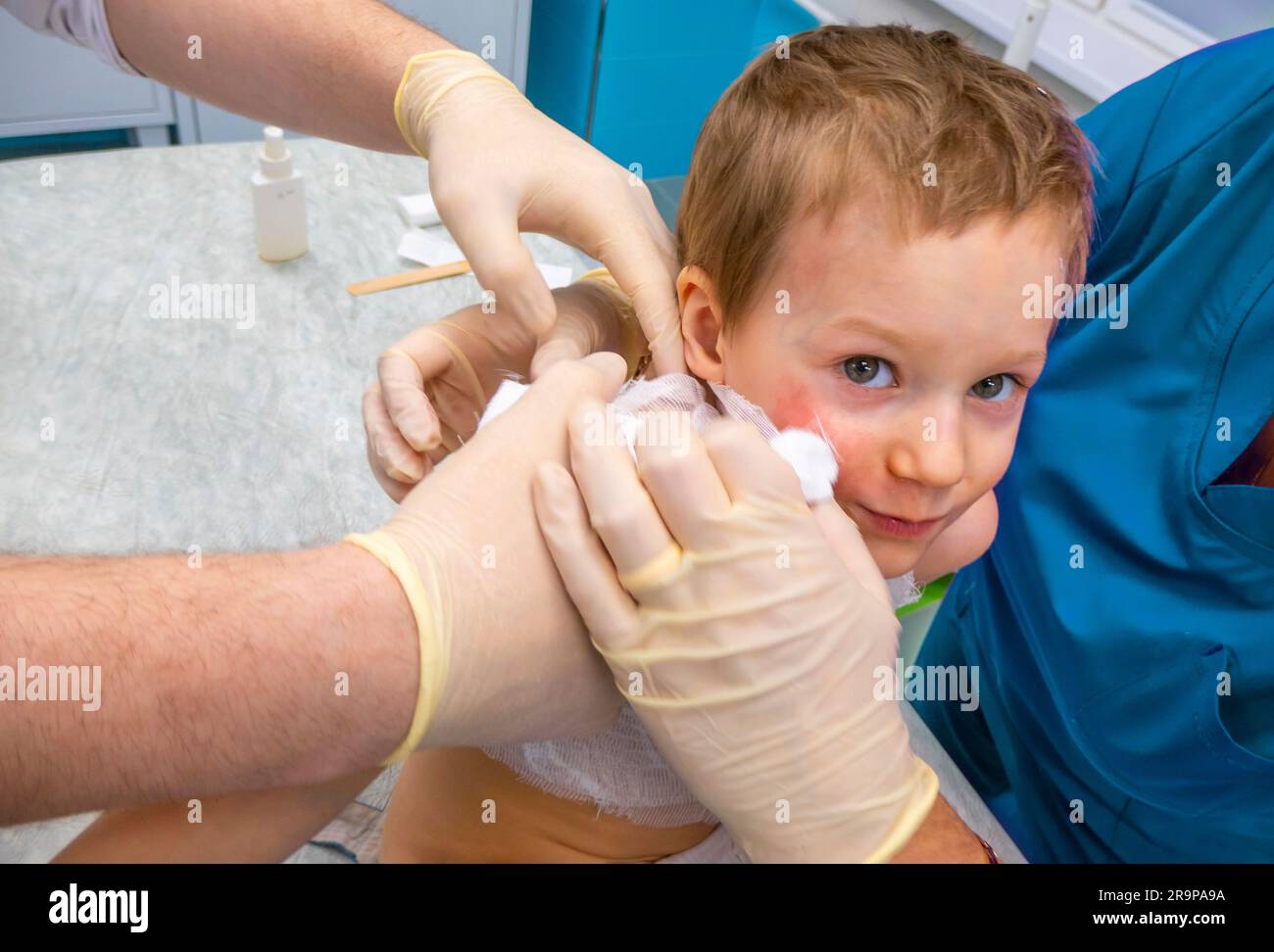 medical procedure dressing a boy with a firstdegree burn from boiling water on his face, neck