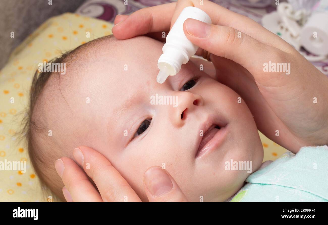 Instillation of medicinal drops in the eye of a child to treat