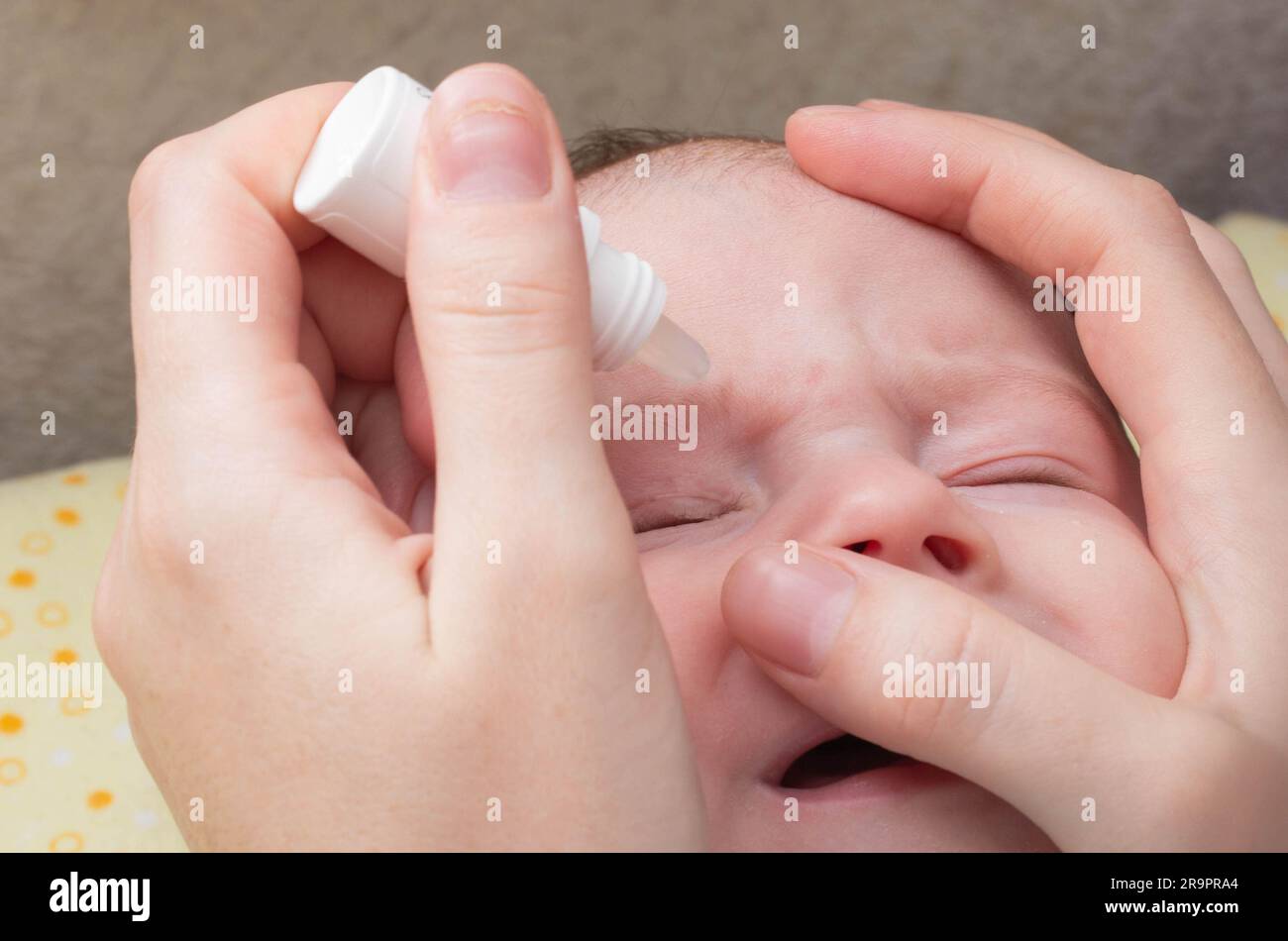 A mother instills medicinal drops in the child's eye to treat pus and tears. Eye drops with vitamins. Stock Photo