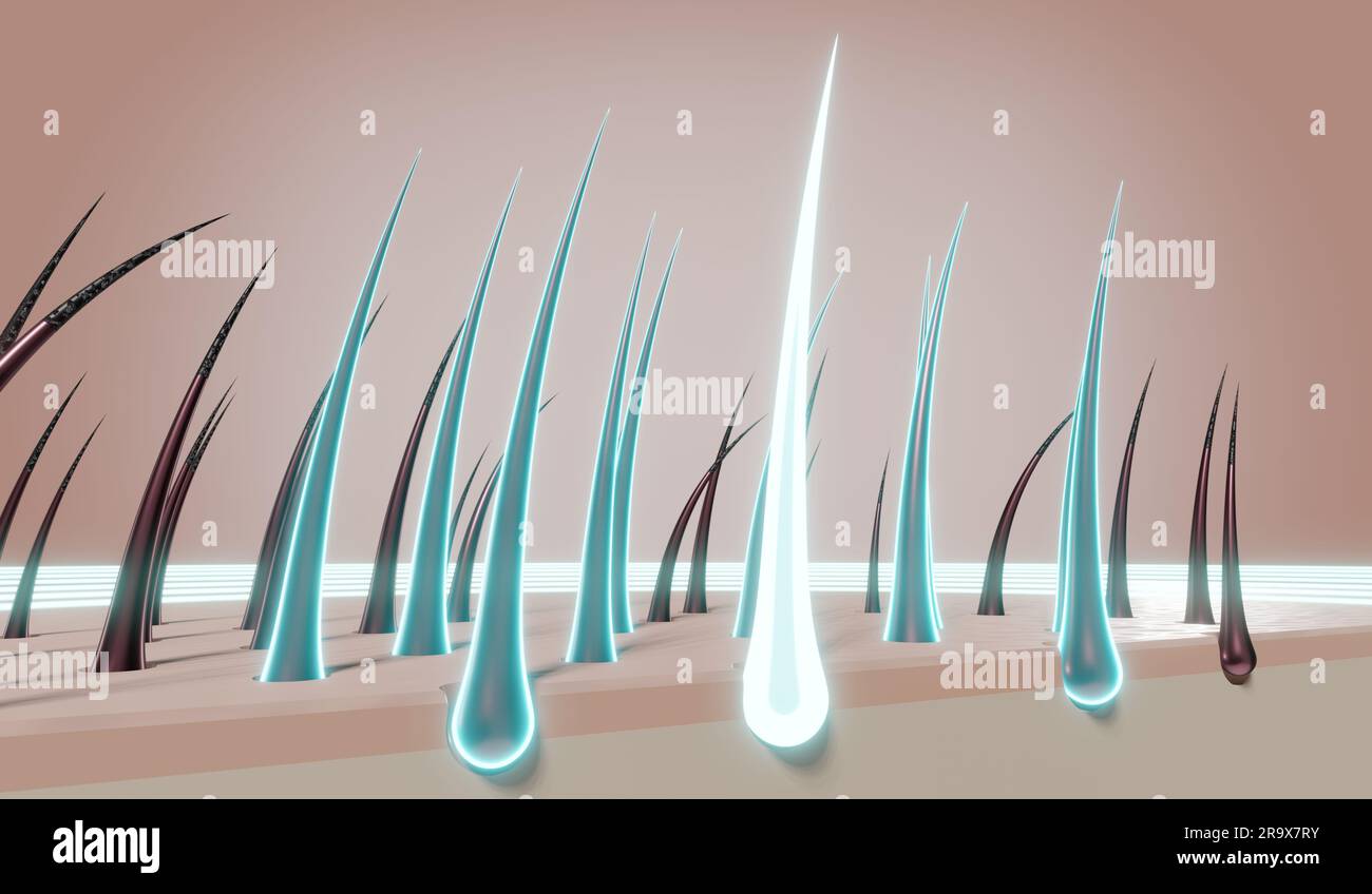 Hair follicles - regeneration concept - 3D illustration Stock Photo - Alamy