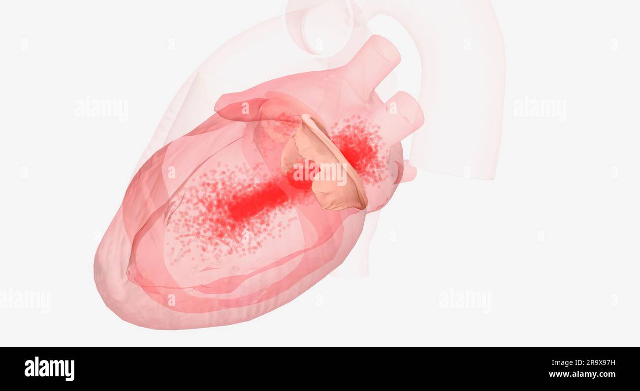 The mitral valve is located between the left atrium and the left ventricle 3D rendering Stock