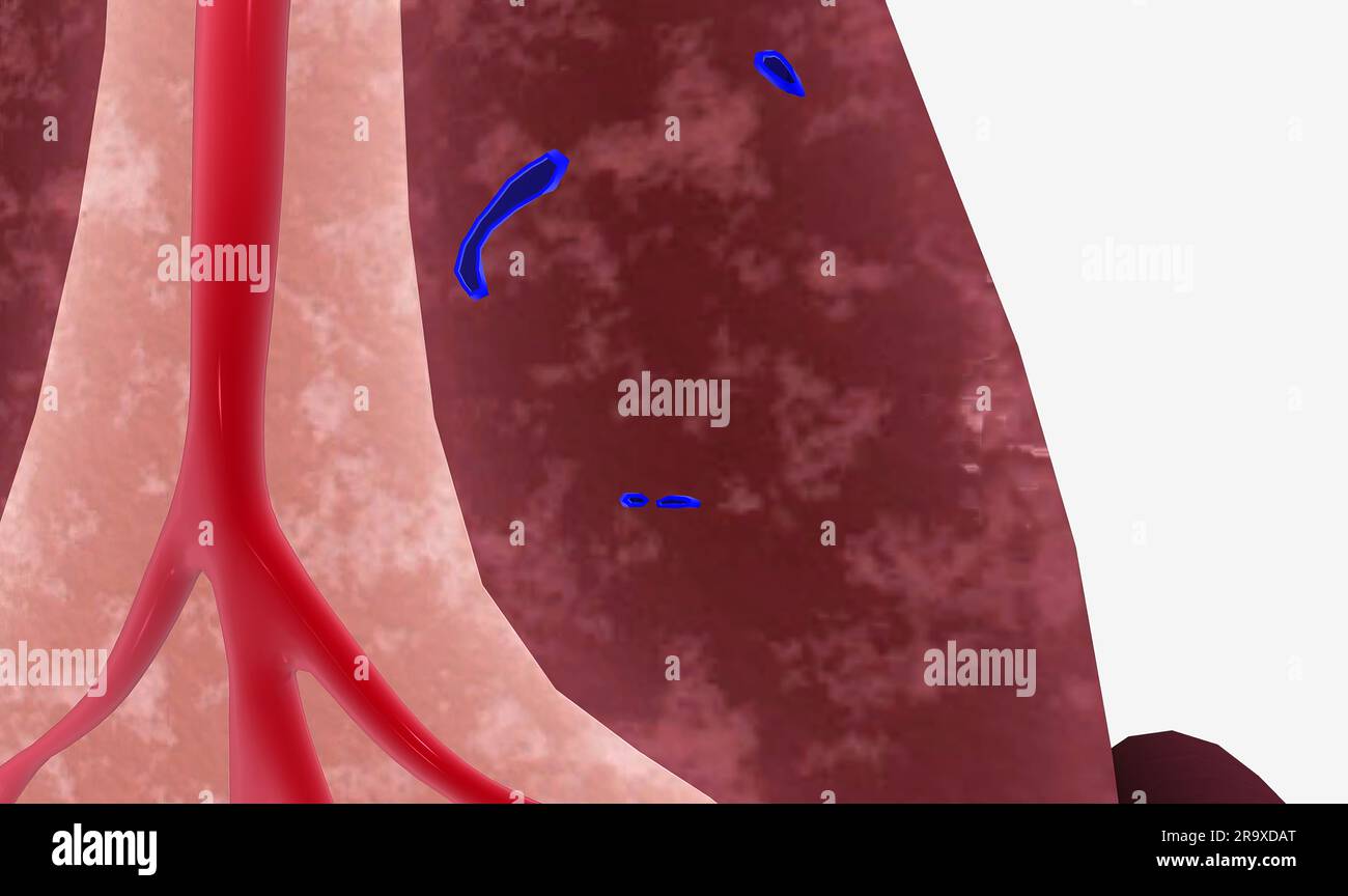 The spleen supports the lymphatic system by filtering blood and