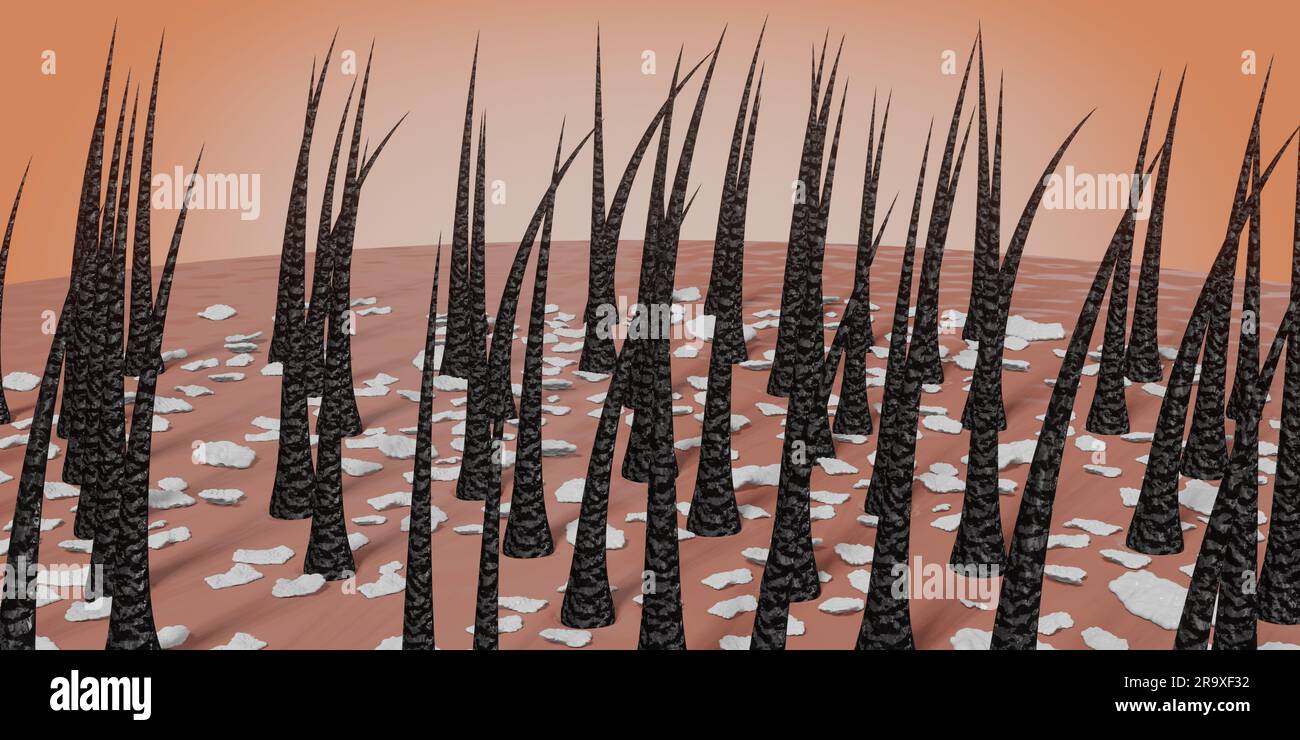 Hair follicles and dandruff under microscope - 3D illustration Stock