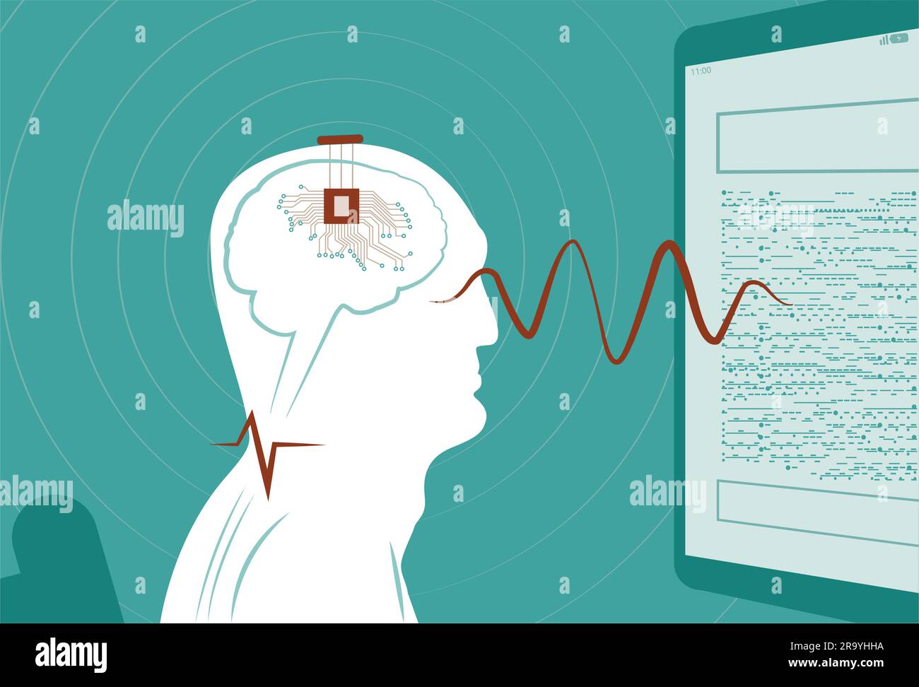 Brain-computer interfaces: the innovative key to unlocking neurological ...