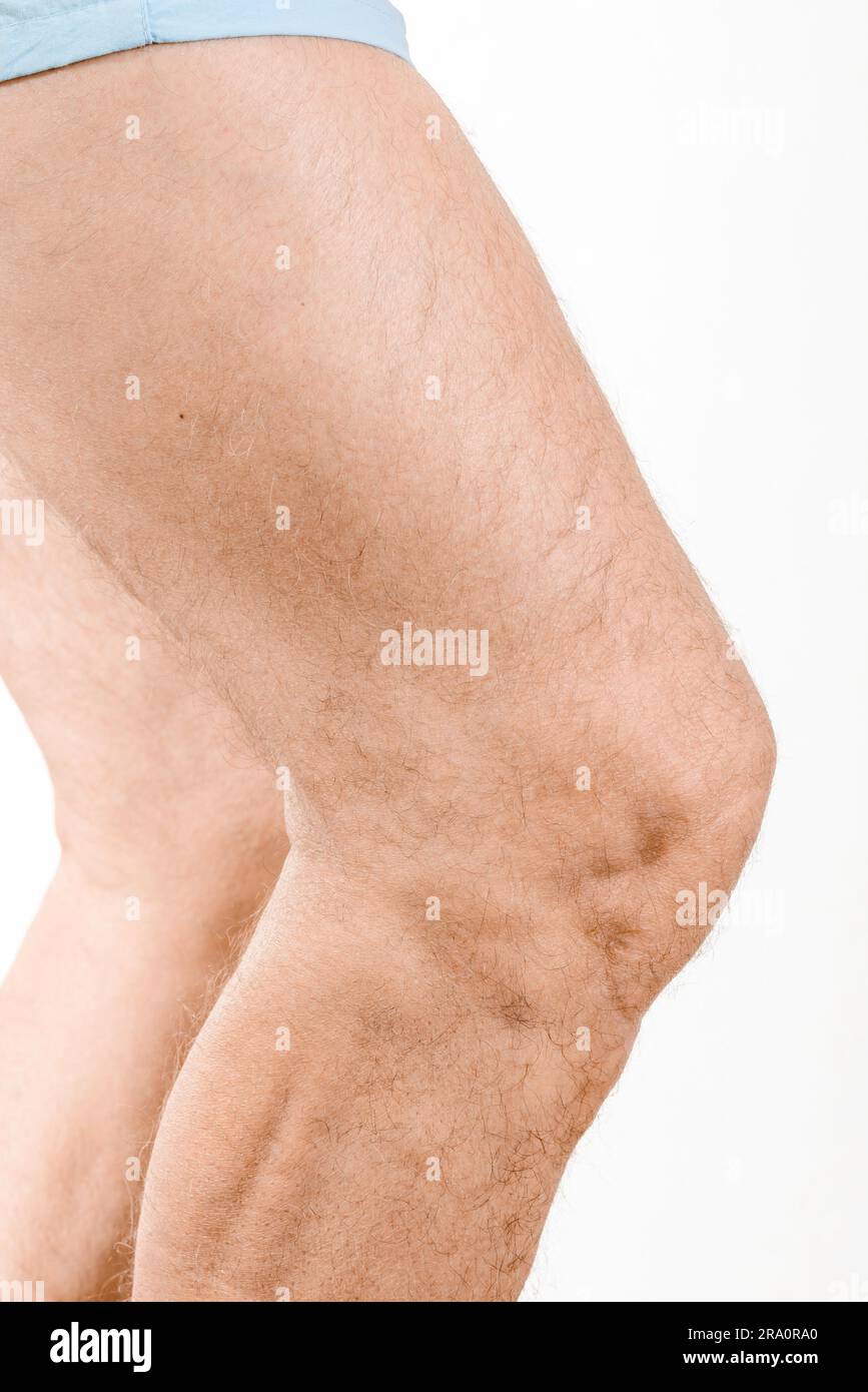 Profile view of a man's knee Stock Photo
