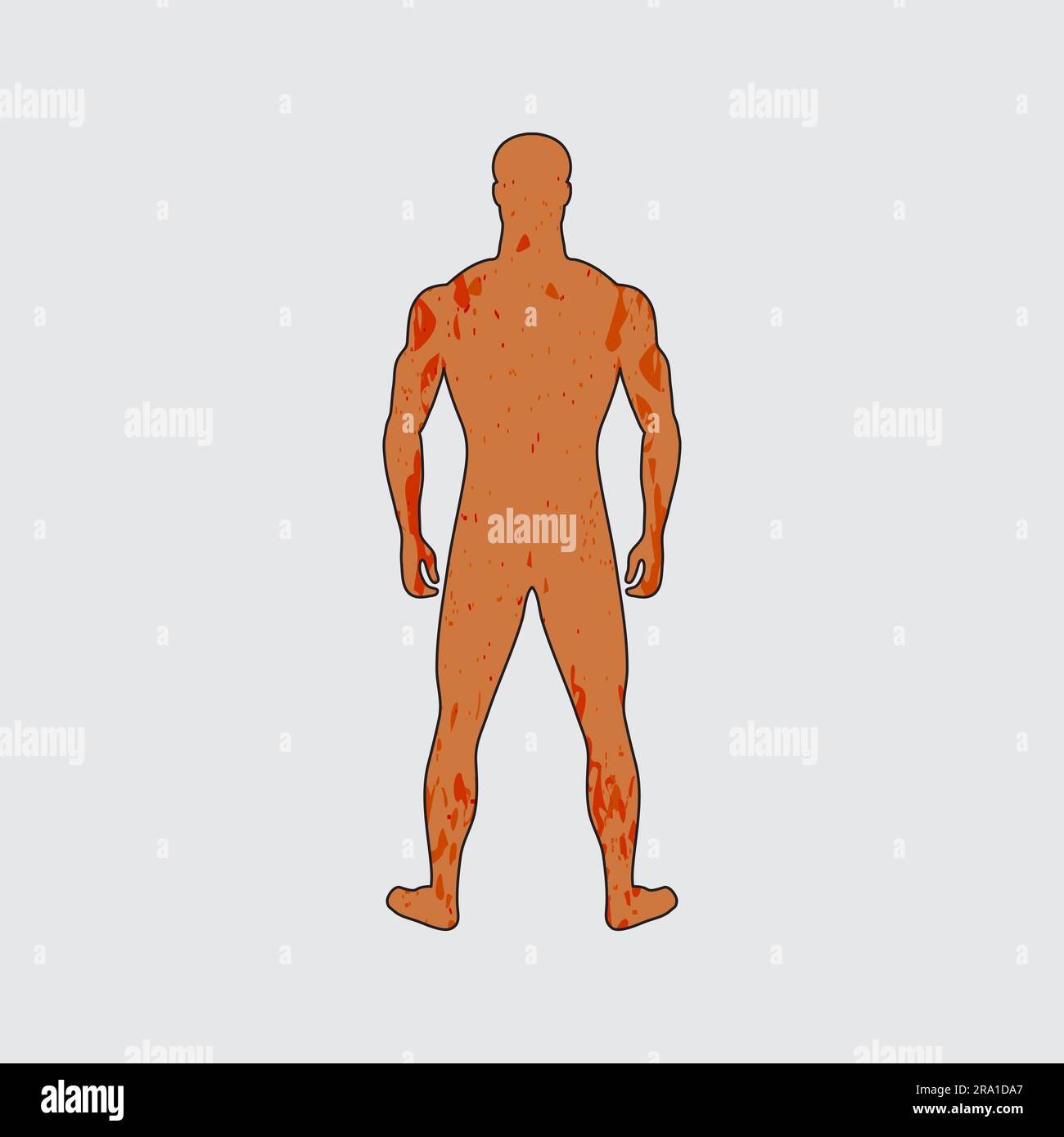 Cartoon Menigitis Rash Adult male with painful rash. Unknown person. Spots all over body ...