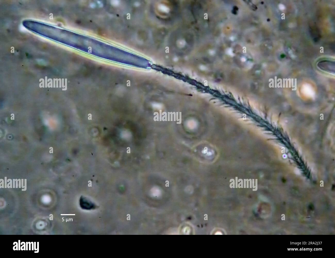 Expanded stinging cell (cnidocyte or nematocyst) from the anemone Aiptasia sp. Stock Photo