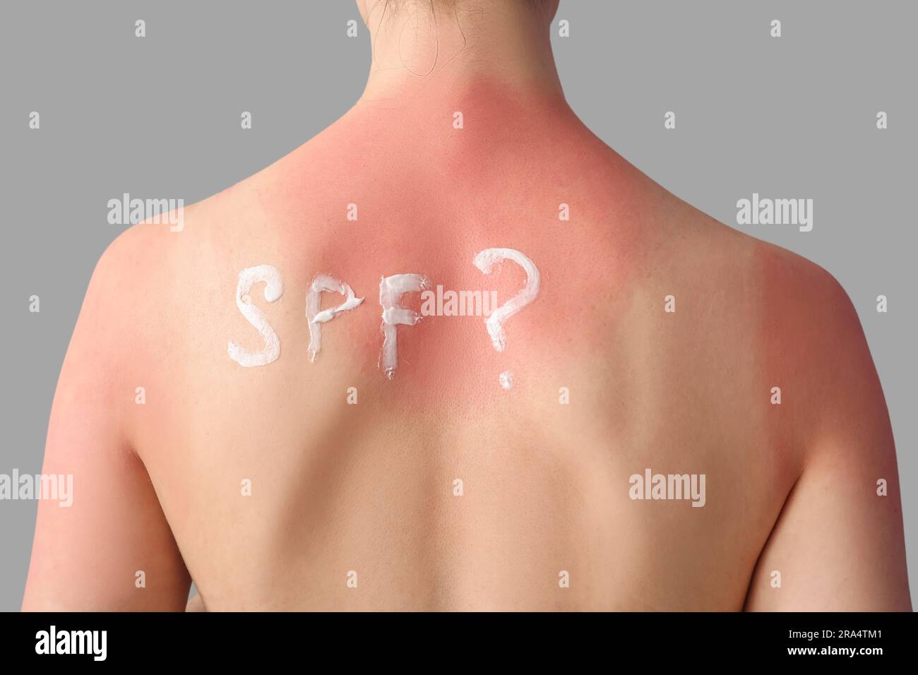 Allergic young woman with sunburned skin and question SPF? on grey
