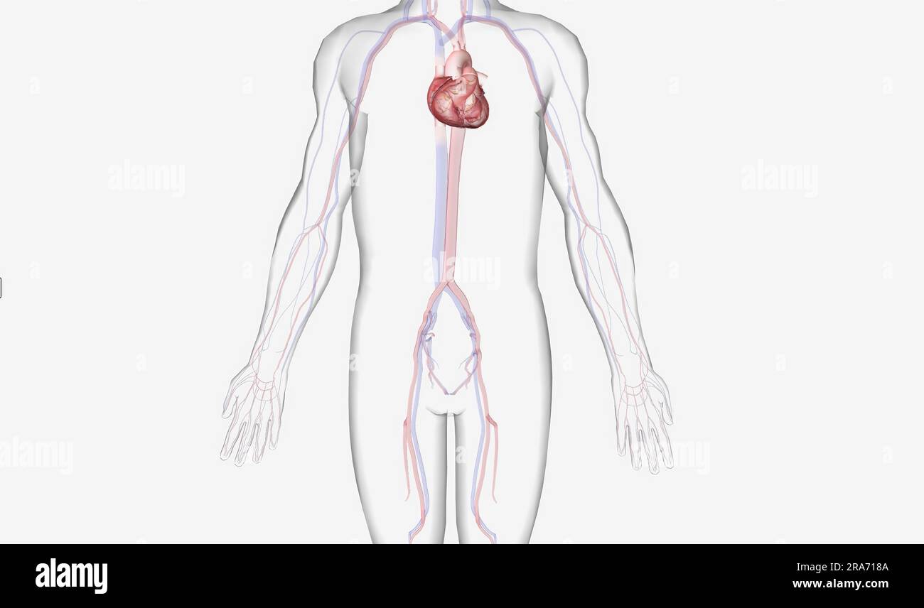 The IABP provides assistance during cardiogenic shock, a serious