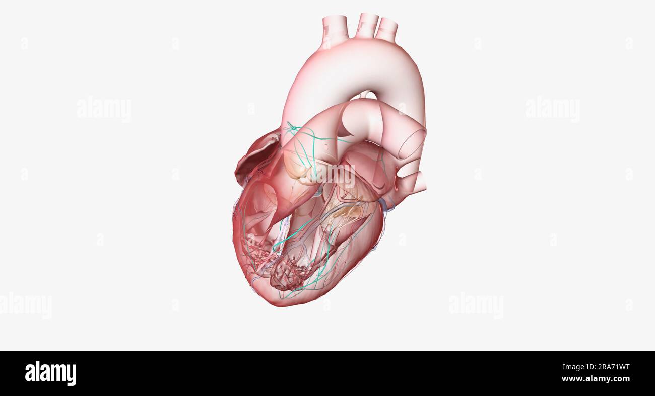 Atrioventricular Nodal Reentry Tachycardia, Conduction System With each