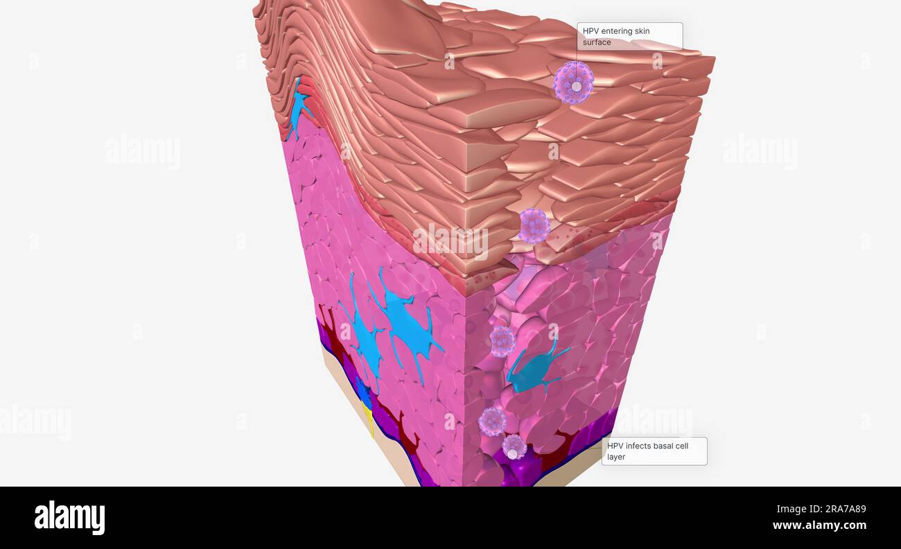 HPV enters the body through a small cut or injury on the skin surface. 3D rendering Stock Photo