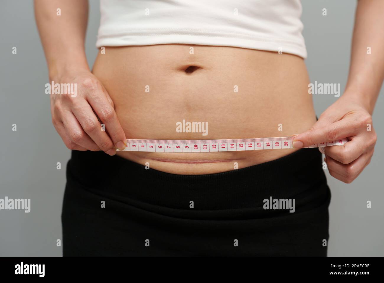 woman using tape measuring the csection scar of cesarean on her belly Stock Photo Alamy