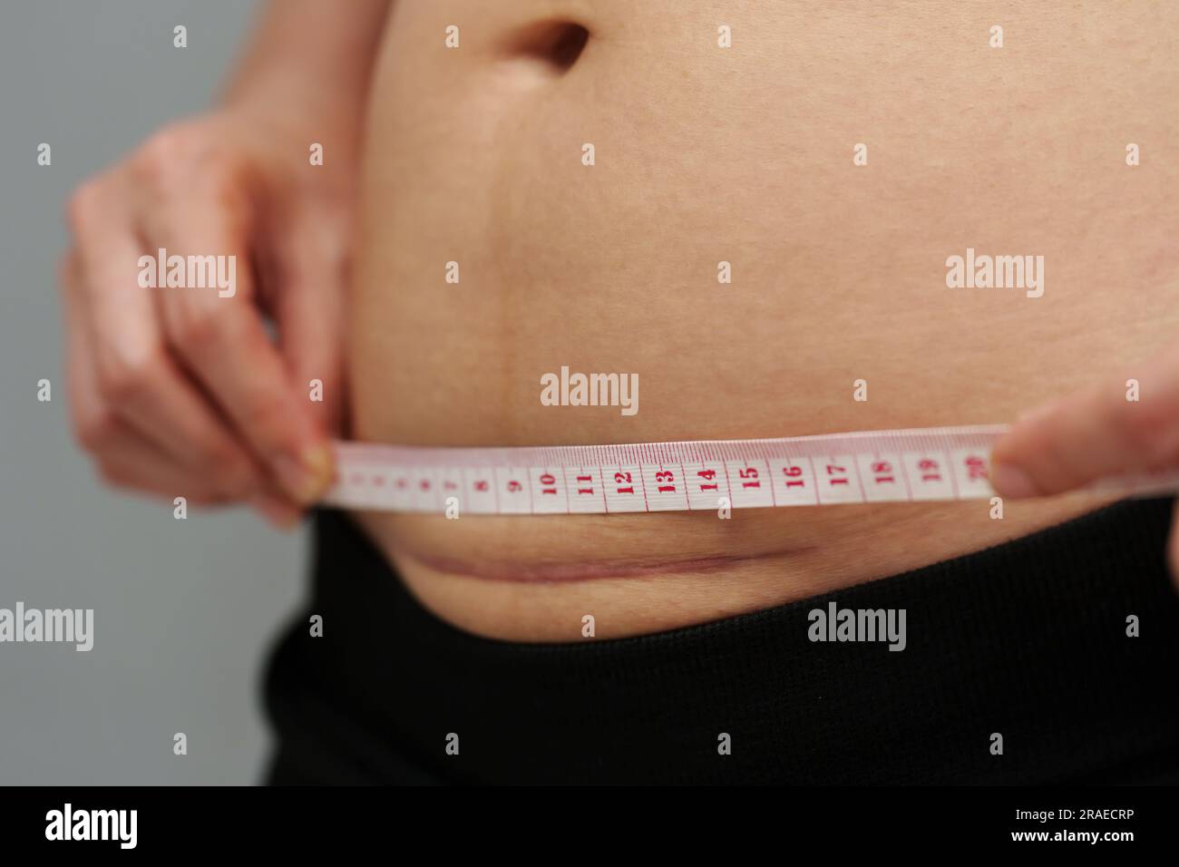 woman using tape measuring the csection scar of cesarean on her belly