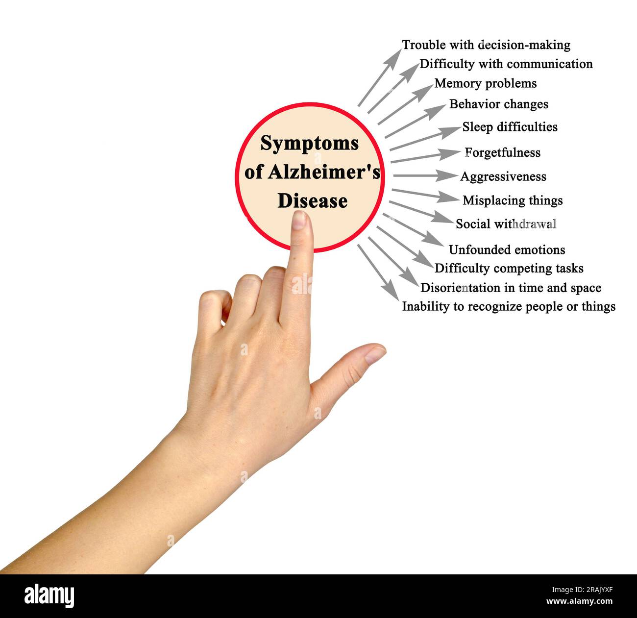 Main Symptoms of Alzheimer's Disease Stock Photo Alamy