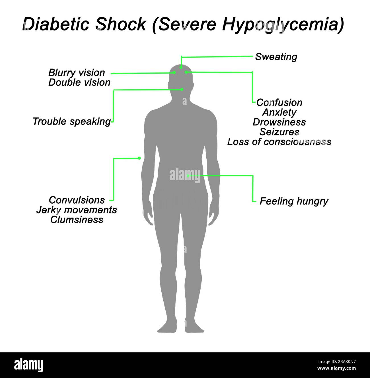Diabetic Shock (Severe Hypoglycemia Stock Photo Alamy