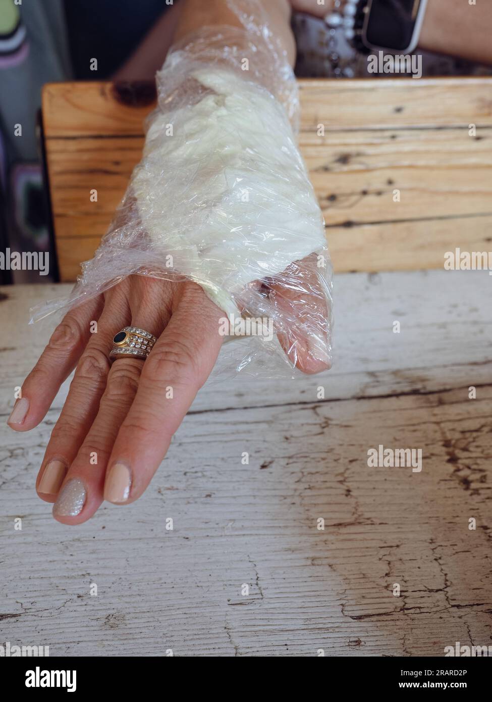 woman wrist wrapped in cabbage leaves compress for anti inflammatory