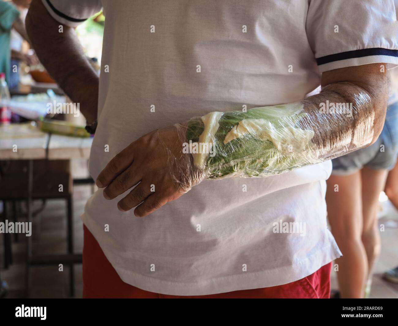 woman wrist wrapped in cabbage leaves compress for anti inflammatory