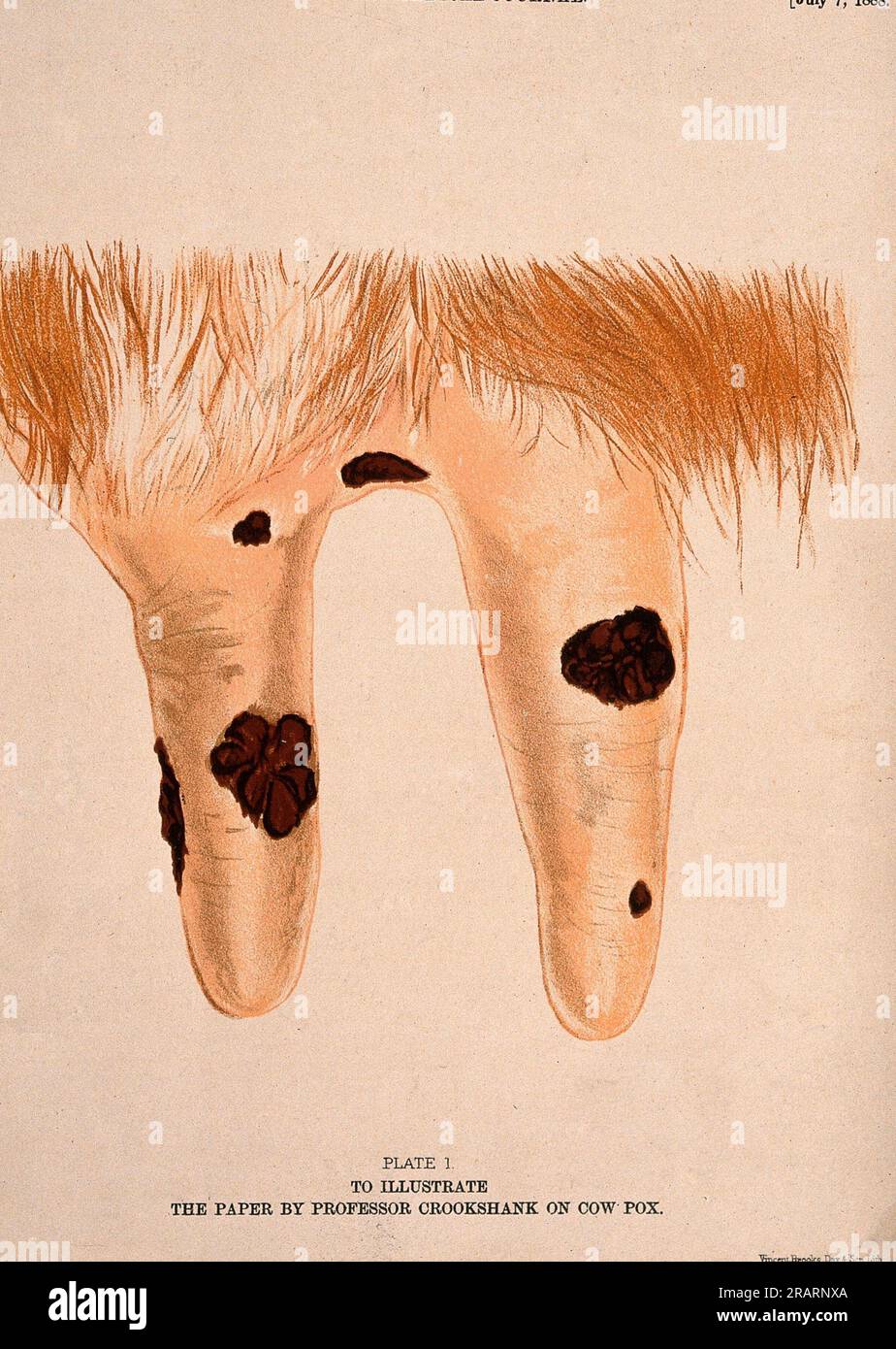 A cow's udder with vaccinia pustules. Chromolithograph. - Lettering